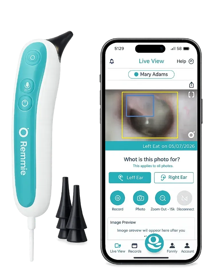 The Remmie 4 at-home digital USB otoscope shown with the companion app on a phone displaying a live view of an eardrum