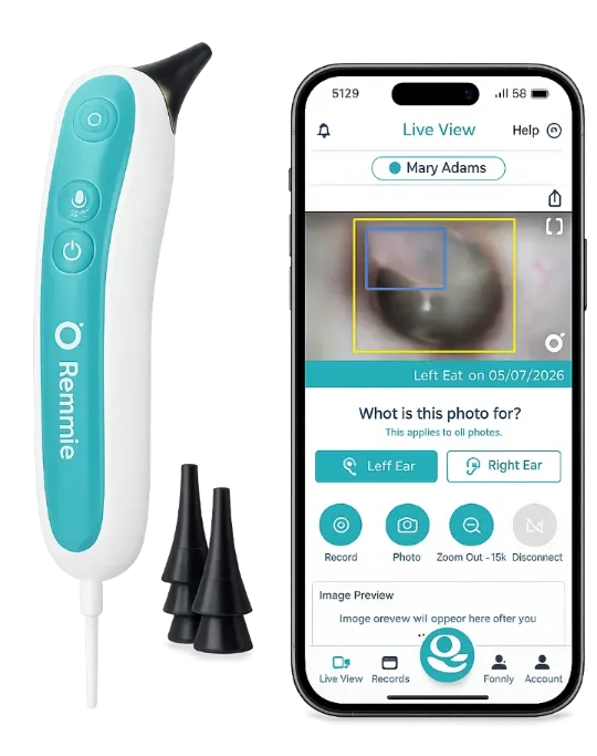 The Remmie 4 at-home digital USB otoscope with replaceable ear tips, shown next to the companion app